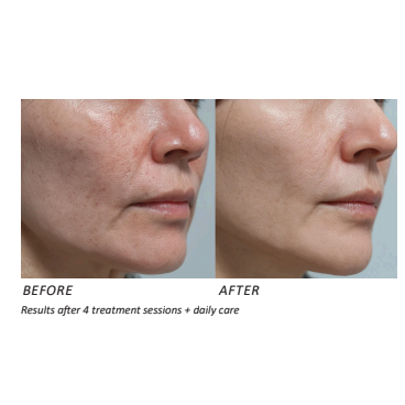 Utsukusy NAD2+ PROFESSIONAL procedūros rinkinys 5 Utsukusy NAD2+ PROFESSIONAL procedūros rinkinys 5