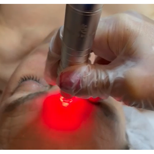 Utsukusy Enpitsu Derma Pen PRO.7 Mezoterapijos prietaisas (dermapen) 6 Utsukusy Enpitsu Derma Pen PRO.7 Mezoterapijos prietaisas (dermapen) 6